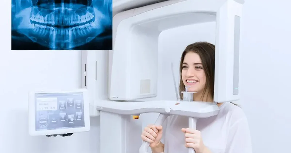 OPG X-Ray Cost in Dubai: Dental Panoramic Scan Prices (2026)