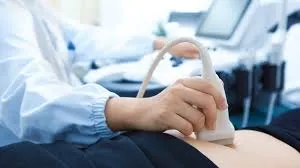 Carotid Doppler Ultrasound: Stroke Prevention Guide