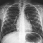 X-Ray Scan procedure at DCDC Dubai Healthcare City