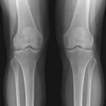 Knee X-Ray procedure at DCDC Dubai Healthcare City